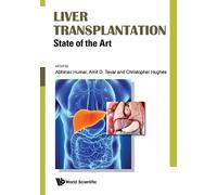 Abhinav Humar Liver Transplantation: State Of The Art (Copertina rigida)