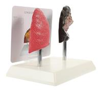 ABOOFAN Modello Anatomico Polmonare Didattico in Pvc, Modello Patologico di Confronto per Insegnamento Medico, Scuola e Facoltà di Scienze della Salute