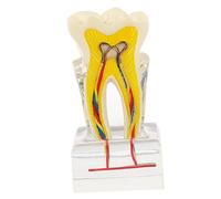 ABOOFAN Modello Insegnamento con Nervi Rimovibili per Studio e Implantare Didattica Ortodontica e Dimostrazione Pazienti