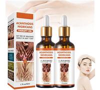 Acanthosis Nigricans Therapy Oil, Dark Knuckle Whitening Serum, Acanthosis Nigricans Relief Oil, Dark Spots Cream Body Whitening Serum, Dark Spot Corrector Oil (2 Pcs)