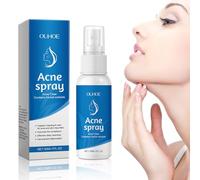 Acido ipocloroso Spray,Spray per viso, sicuro sulla pelle, adatto per cuoio capelluto secco e post-operatorio. Idrata e protegge la tua pelle (normal, Acido ipocloroso 1)
