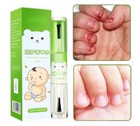 Acqua Anti Mangiarsi le Unghie, Protezione Sicura Contro Il Del In Bocca Per Bambini, 10ml Non Appiccicoso Per Bambini Piccoli