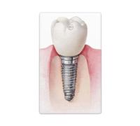 Acquerello A Impianto Dentale Singolo Toggle Blank Wall Plate Interruttore Luce Copertura Decorativo 1 Gang per Cucina Camera Bagno Dimensioni 11.4x7cm