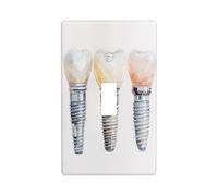Acquerello Tre Impianto Dentale Interruttore Dentale Copertura Decorativa Singola Toggle 1 Gang Piastra Da Parete per Cucina Agriturismo Camera Da Letto Bagno