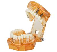 Adulti Denti Replica Modello, Scuola e materiale didattico Materiali didattici Disease Dimostrazione dimostrativa Studio Denti didattici Modello per dentista e scuola Arancione