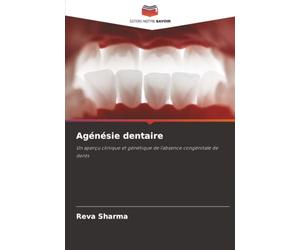 Agénésie dentaire: Un aperçu clinique et génétique de l'absence congénitale de dents
