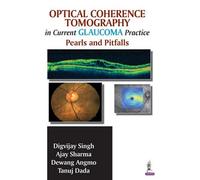Ajay Sharma Digvijay Singh Dew Optical Coherence Tomography in Curre (Tascabile)