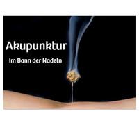 Akupunktur - Im Bann der Nadeln (Wandkalender 2026 DIN A3 quer), CALVENDO Monatskalender: Jeden Monat im Einklang mit dem Qi