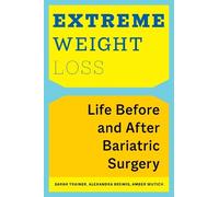 Alexandra Brewis Sarah Trainer Amber Wutic Extreme Weight Los (Copertina rigida)