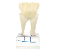 Alipis Modello Ingrandito per Educazione Orale Studio Analisi e Dimostrazione Rimozione Denti per Insegnamento Professionale e Comunicazione Pazienti