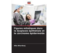 Alka Bhardwaj Figures mitotiques dans la dysplasie épithéliale et le (Tascabile)