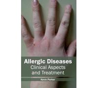 Allergic Diseases: Clinical Aspects and Treatment (Copertina rigida)
