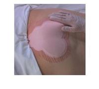 Allevyn MEDICAZIONE IDROCELLULARE ADESIVA STERILE CONFORMATA PER LAREGIONE SACRALE ASSORBENTE IN SCHIUMA DI POLIURETANO ALLEVYN SACRUM 22,5X22,1CM 10PZ