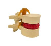 Almencla Modello di Vertebre Lombari Compatto | Rappresentazione dei Nervi Spinali, Modello di Ernia del Disco, Struttura in PVC, per Studio Medico, Medici, Insegnanti