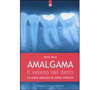 Amalgama. Il veleno nei denti. La causa nascosta di molte malattie