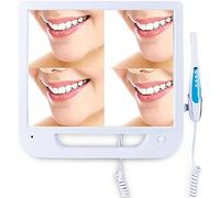 Amhuui Telecamera Intraorale Dentale, Telecamera Endoscopica Medica Telecamera Intraorale Dentale, VGA con Monitor da 17 Pollici/Scanner Intraorale Digitale CMOS Odontoiatria