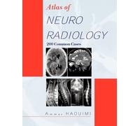 AMMAR HAOUIMI Atlas Of NEURORADIOLOGY (Tascabile)