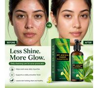 Ammuri Detergente Viso Anti Acne Con Olio Di Tea Tree Biologico 100ml UK