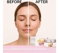 Ammuri Retinolo Esfoliante 100G Con Microperle per Acne & Rejuvenation