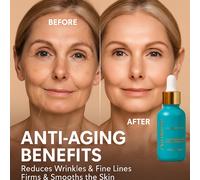 Ammuri Retinolo Siero 5% Max Antiage Acne Scuro Circles Idratazione