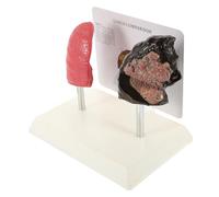 Amosfun Modello Anatomico Polmonare Didattico Confronto Polmone e Sano Modello per Scuola e Istituti Formativi