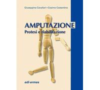Amputazione. Protesi e riabilitazione
