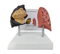 AMULONG Human Organ Model Modello di Polmone Umano Confronto tra Fumante E Normale Organo Sistema Respiratorio Organi Educativi