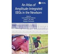 An Atlas of Amplitude-Integrated EEGs in the Newborn