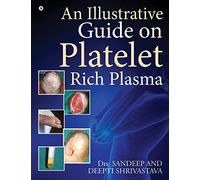 An Illustrative Guide on Platelet Rich Plasma