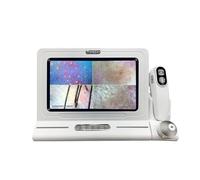 Analizzatore Cuoio Capelluto, Macchina per Analisi del Capello, Microscopio Cutaneo, Schermo LCD HD 11" con Sonda 50X e 200X, Nessun Download App, Diagnosi Pelle Professionale per Casa e Salone