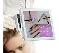 Analizzatore di capelli e diagnosi della pelle, telecamera professionale da 15 pollici per cuoio capelluto, dispositivo di analisi di capelli e cuoio capelluto ad alta risoluzione, con memor