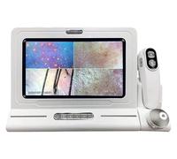 Analizzatore di capelli for diagnosi cutanea, rilevatore di follicoli piliferi del cuoio capelluto, analizzatore di pelle al microscopio digitale portatile, schermo HD da 11 pollici