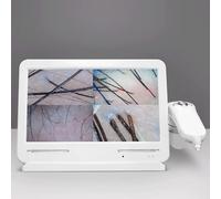 Analizzatore di capelli per capelli e pelle di capelli, scanner per test follicolari HD da 10,1 pollici