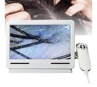Analizzatore di Capelli per Diagnosi della Pelle Microscopio professionale per il cuoio capelluto, rilevatore di peli e pelle per il cuoio capelluto, funzionamento semplice