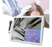 Analizzatore di capelli per diagnosi della pelle, rilevatore di cuoio capelluto con lenti di ingrandimento 70x/200x per l'ispezione del cuoio capelluto e dei follicoli piliferi, rilevamento