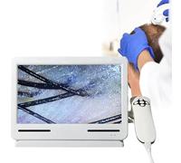 Analizzatore di Capelli per Diagnosi della Pelle rilevazione dei peli della pelle, tester di rilevamento e rilevazione, leggero e portatile, ideale per risolvere problemi del cuoio capelluto