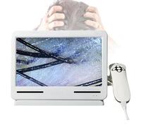 Analizzatore per capelli e diagnosi della pelle, scanner per analisi del microscopio del cuoio capelluto da 10,1 pollici, rilevamento dei pori del cuoio capelluto, identificazione del grado