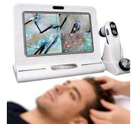Analizzatore portatile del cuoio capelluto con schermo HD Microscopio digitale Tester per follicoli piliferi e cute Per uso domestico Uso professionale in salone