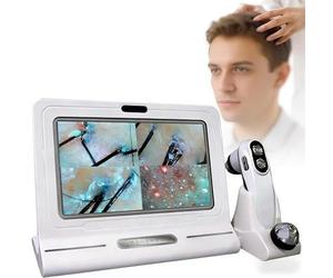 Analizzatore professionale del cuoio capelluto con display HD da 11" Sonda portatile con impugnatura Endoscopio per capelli e pelle per consulenze in centri estetici per la testa