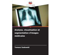 Analyse, visualisation et segmentation d'images médicales