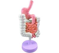 Anatomia dello stomaco, intestino crasso, cieco, retto, duodeno, struttura degli organi interni umani, lesione gastrointestinale del colon, modello anatomico delle malattie intestinali