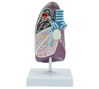 anatomia, Modello anatomico del polmone patologico, modello umano a grandezza naturale 2/3 for la dimostrazione didattica della ricerca medica - Comunicazione medico-paziente