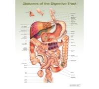 Anatomical Chart Compan Diseases of the Digestive Tract Anatomical Char (Poster)