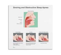 Anatomical Chart of and Sleep Professional Reference Poster Educational Office Decor Clinic Wall-Art Visualization Aid(Unframed,16x24inch(40x60cm))