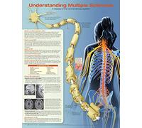 Anatomical Chart Understanding Multiple Sclerosis