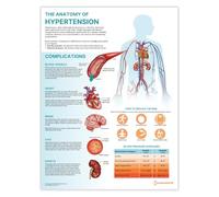 AnatomyStuff The Anatomy of Hypertension Poster/Chart 45x60cm, 18x24 pollici, Understanding Hypertension, Blood Pressure Patient Education Guide