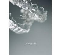 Andrade Neto Alineadores Invisibles (Tascabile)