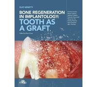 Andrea Cusasco Marco Casasco Andre Bone regeneration in impla (Copertina rigida)