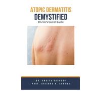 Ankita Kashyap Prof Krishna N Sharma Atopic Dermatitis Demystified (Tascabile)