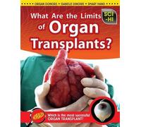 Anna Claybourne What Are the Limits of Organ Transplants? (Copertina rigida)